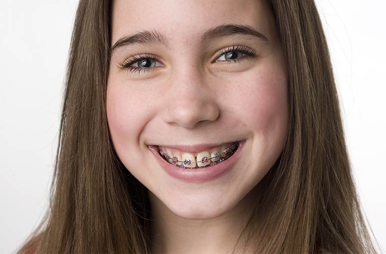 girl smiling after her first orthodontic visit